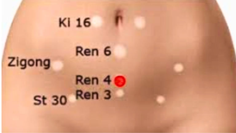 fertility acupuncture points